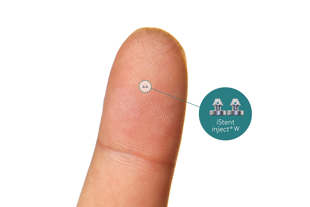 水晶体再建術併用眼内ドレーン挿入術（iStent）