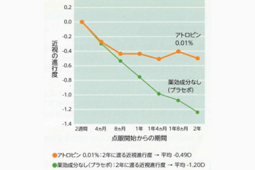 マイオピンが選ばれる理由とは？